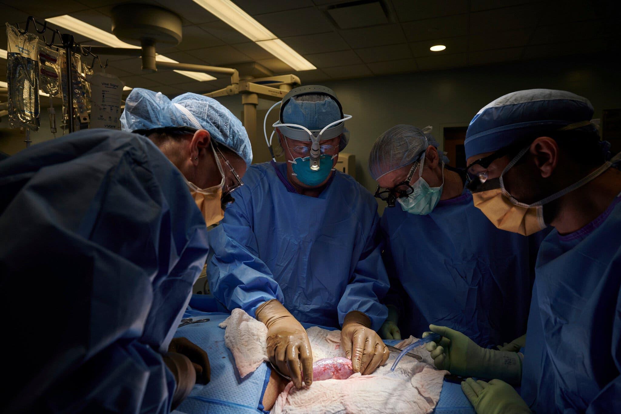 N.Y.U Surgeons Successfully Test Pig Kidney Transplant in Human Patient