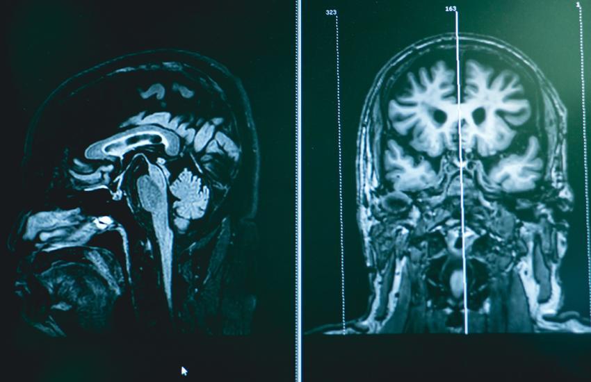 Atthapon Raksthaput // Shutterstock