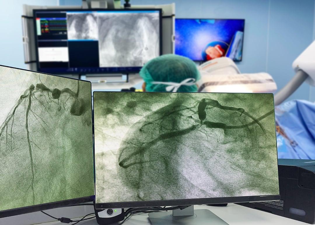 Do you need a heart checkup?