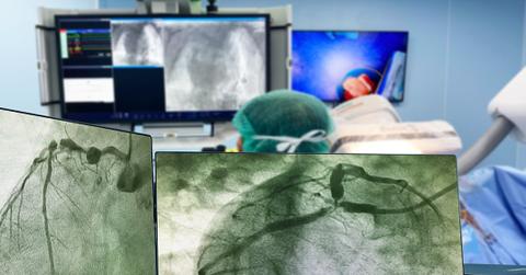 Do you need a heart checkup?